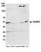 CD2 Cytoplasmic Tail Binding Protein 2 antibody, A304-827A, Bethyl Labs, Western Blot image 