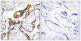 Pleckstrin Homology Like Domain Family A Member 2 antibody, abx013649, Abbexa, Western Blot image 