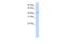 SPARC (Osteonectin), Cwcv And Kazal Like Domains Proteoglycan 3 antibody, A03151, Boster Biological Technology, Western Blot image 