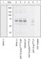 Zeta Chain Of T Cell Receptor Associated Protein Kinase 70 antibody, 44-232G, Invitrogen Antibodies, Western Blot image 