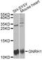 Gonadotropin Releasing Hormone 1 antibody, A5625, ABclonal Technology, Western Blot image 