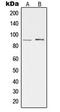 Protein Kinase CGMP-Dependent 2 antibody, MBS820244, MyBioSource, Western Blot image 