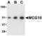 Poly(RC) Binding Protein 4 antibody, NBP1-76729, Novus Biologicals, Western Blot image 