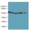 Tetratricopeptide Repeat Domain 38 antibody, LS-C377746, Lifespan Biosciences, Western Blot image 
