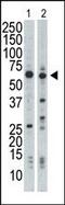 Nuclear Receptor Binding Protein 1 antibody, 63-388, ProSci, Western Blot image 