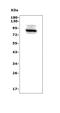 ADAM Metallopeptidase Domain 28 antibody, A06873-2, Boster Biological Technology, Western Blot image 