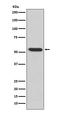 Matrix metalloproteinase-3 antibody, M00775, Boster Biological Technology, Western Blot image 