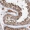Inositol Polyphosphate-4-Phosphatase Type II B antibody, PA5-58056, Invitrogen Antibodies, Immunohistochemistry frozen image 