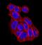 EPH Receptor A2 antibody, MAB3035, R&D Systems, Immunohistochemistry paraffin image 