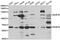 BUB1 Mitotic Checkpoint Serine/Threonine Kinase B antibody, MBS126367, MyBioSource, Western Blot image 