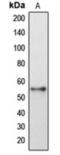 Gasdermin E antibody, orb360701, Biorbyt, Western Blot image 