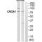 cGMP-gated cation channel alpha-1 antibody, A05494, Boster Biological Technology, Western Blot image 