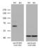 Proprotein Convertase Subtilisin/Kexin Type 9 antibody, LS-C792967, Lifespan Biosciences, Western Blot image 