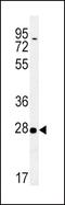 Stratifin antibody, PA5-25884, Invitrogen Antibodies, Western Blot image 