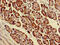 Parvin Alpha antibody, CSB-PA868328LA01HU, Cusabio, Immunohistochemistry paraffin image 