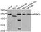 Phosphatidylinositol-5-Phosphate 4-Kinase Type 2 Alpha antibody, STJ29582, St John