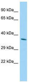 Estradiol 17-beta-dehydrogenase 12 antibody, TA341998, Origene, Western Blot image 