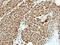 Zinc Finger Protein 83 antibody, NBP2-21050, Novus Biologicals, Immunohistochemistry paraffin image 