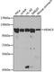 Histone Deacetylase 4 antibody, GTX32646, GeneTex, Western Blot image 