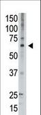 MAGE Family Member D2 antibody, LS-C100415, Lifespan Biosciences, Western Blot image 