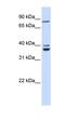 Tubulin Polyglutamylase Complex Subunit 2 antibody, orb325973, Biorbyt, Western Blot image 