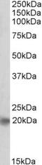 Achaete-Scute Family BHLH Transcription Factor 3 antibody, NBP1-68871, Novus Biologicals, Western Blot image 