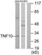 TNF Superfamily Member 10 antibody, TA312997, Origene, Western Blot image 