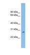 PH Domain Containing Endocytic Trafficking Adaptor 1 antibody, NBP1-57739, Novus Biologicals, Western Blot image 