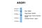 Asialoglycoprotein Receptor 1 antibody, ARP33805_P050, Aviva Systems Biology, Western Blot image 