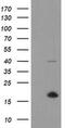 TPD52 Like 3 antibody, MA5-26024, Invitrogen Antibodies, Western Blot image 