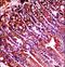 ABL Proto-Oncogene 1, Non-Receptor Tyrosine Kinase antibody, LS-C164283, Lifespan Biosciences, Immunohistochemistry frozen image 