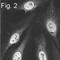 Proteasome Subunit Alpha 5 antibody, NB120-11437, Novus Biologicals, Immunofluorescence image 