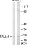 TNF Superfamily Member 13 antibody, EKC1653, Boster Biological Technology, Western Blot image 