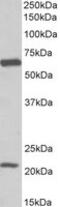 Solute Carrier Family 1 Member 3 antibody, MBS423032, MyBioSource, Western Blot image 