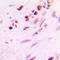 Myogenic Factor 5 antibody, LS-C356199, Lifespan Biosciences, Immunohistochemistry frozen image 