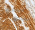 Complement Factor H Related 1 antibody, A2743, ABclonal Technology, Immunohistochemistry paraffin image 