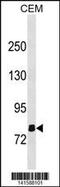 Olfactomedin Like 2B antibody, 60-687, ProSci, Western Blot image 