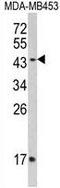 Interferon Gamma Receptor 2 antibody, GTX81601, GeneTex, Western Blot image 