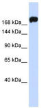 NMMHC-IIA antibody, TA346515, Origene, Western Blot image 