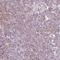 Ribosome Biogenesis Regulator 1 Homolog antibody, NBP2-49323, Novus Biologicals, Immunohistochemistry frozen image 