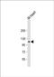 Natriuretic Peptide Receptor 2 antibody, PA5-48674, Invitrogen Antibodies, Western Blot image 