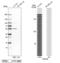 Preferentially Expressed Antigen In Melanoma antibody, NBP1-85418, Novus Biologicals, Western Blot image 