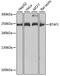 B-TFIID TATA-Box Binding Protein Associated Factor 1 antibody, 19-872, ProSci, Western Blot image 