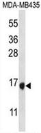 Tachykinin 4 antibody, AP54138PU-N, Origene, Western Blot image 