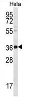 Protein BTG3 antibody, AP50405PU-N, Origene, Western Blot image 