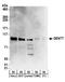 Testis-specific Y-encoded-like protein 2 antibody, A304-012A, Bethyl Labs, Western Blot image 