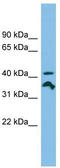 Rag C antibody, TA344689, Origene, Western Blot image 