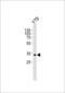 Cone-Rod Homeobox antibody, 61-066, ProSci, Western Blot image 