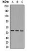 Mitogen-Activated Protein Kinase Kinase Kinase 8 antibody, LS-C358799, Lifespan Biosciences, Western Blot image 