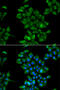 Cystinosin, Lysosomal Cystine Transporter antibody, 22-534, ProSci, Immunofluorescence image 